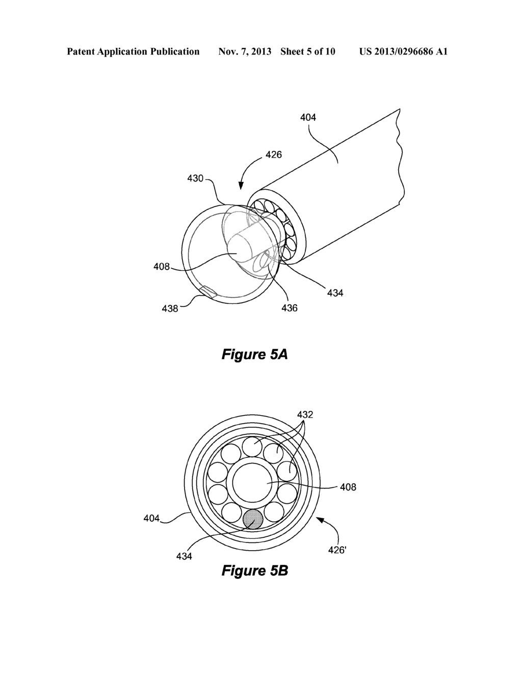 Systems and Methods for Maintaining a Narrow Body Lumen - diagram, schematic, and image 06