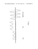 RIGHT ATRIUM INDICATOR diagram and image