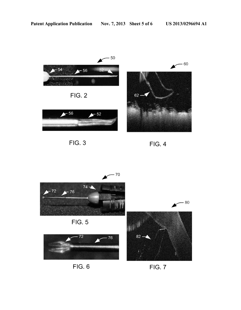 SURGICAL INSTRUMENTS FOR OCT ASSISTED PROCEDURES - diagram, schematic, and image 06