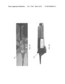 CATHETER-BASED OFF-AXIS OPTICAL COHERENCE TOMOGRAPHY IMAGING SYSTEM diagram and image