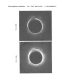 CATHETER-BASED OFF-AXIS OPTICAL COHERENCE TOMOGRAPHY IMAGING SYSTEM diagram and image