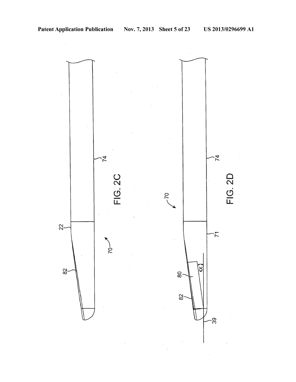 DEVICES AND METHODS FOR TREATMENT OF TISSUE - diagram, schematic, and image 06