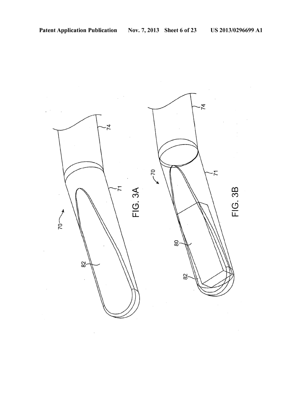 DEVICES AND METHODS FOR TREATMENT OF TISSUE - diagram, schematic, and image 07