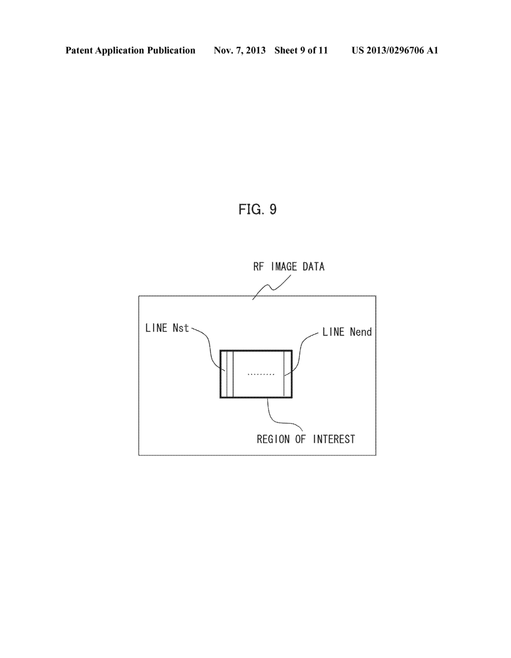 ULTRASOUND DIAGNOSTIC APPARATUS AND SIGNAL PROCESSING METHOD THEREOF - diagram, schematic, and image 10