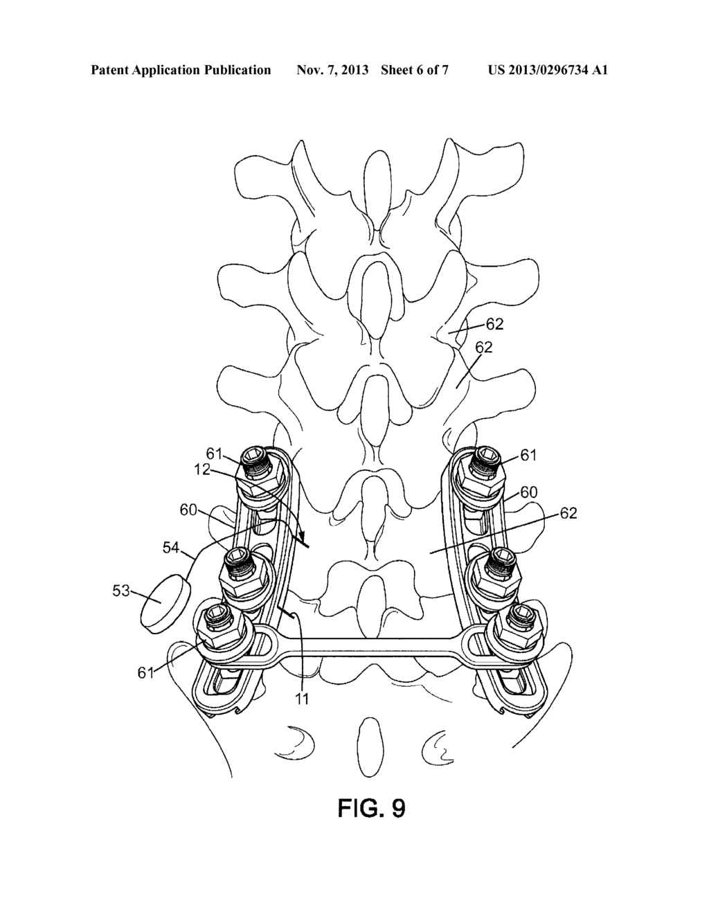 System for the Consolidation of an Individual's Bone Structure, Comprising     a System for Determining the Quality of the Bone Structure - diagram, schematic, and image 07