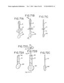 ORAL DEVICE AND METHOD FOR THE USE THEREOF diagram and image