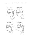 ORAL DEVICE AND METHOD FOR THE USE THEREOF diagram and image