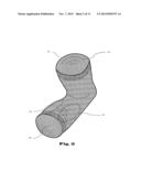 ORTHOSIS FOR MOVEMENT DAMPING diagram and image