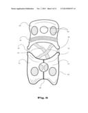 ORTHOSIS FOR MOVEMENT DAMPING diagram and image