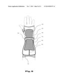 ORTHOSIS FOR MOVEMENT DAMPING diagram and image