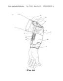 ORTHOSIS FOR MOVEMENT DAMPING diagram and image