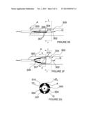 Methods and Apparatus for Performing a Non-Continuous Circumferential     Treatment of a Body Lumen diagram and image