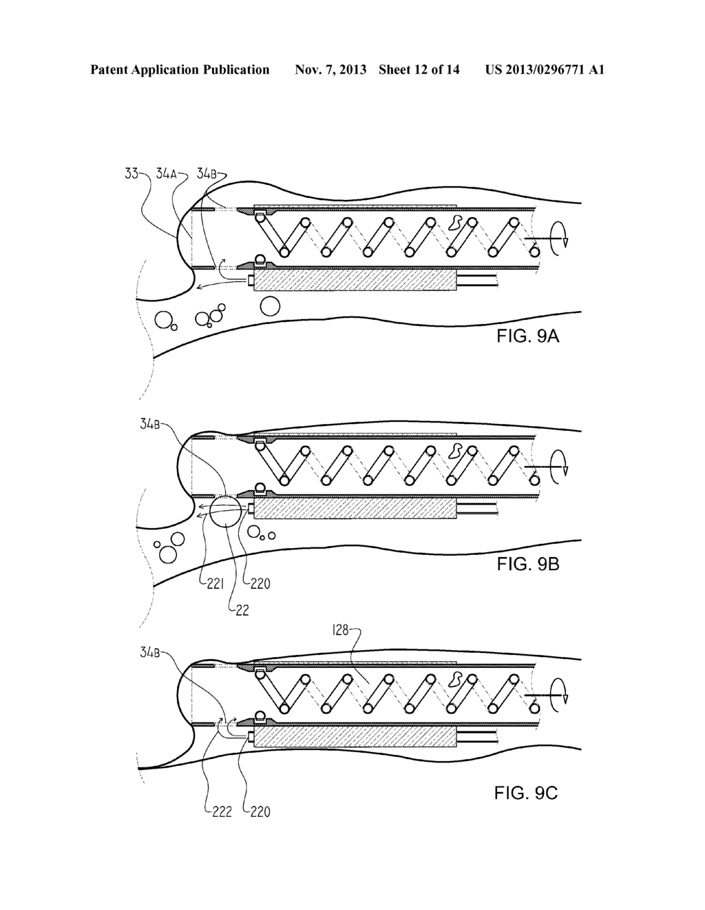 SYSTEMS AND METHODS FOR CLEANING BODY CAVITIES - diagram, schematic, and image 13