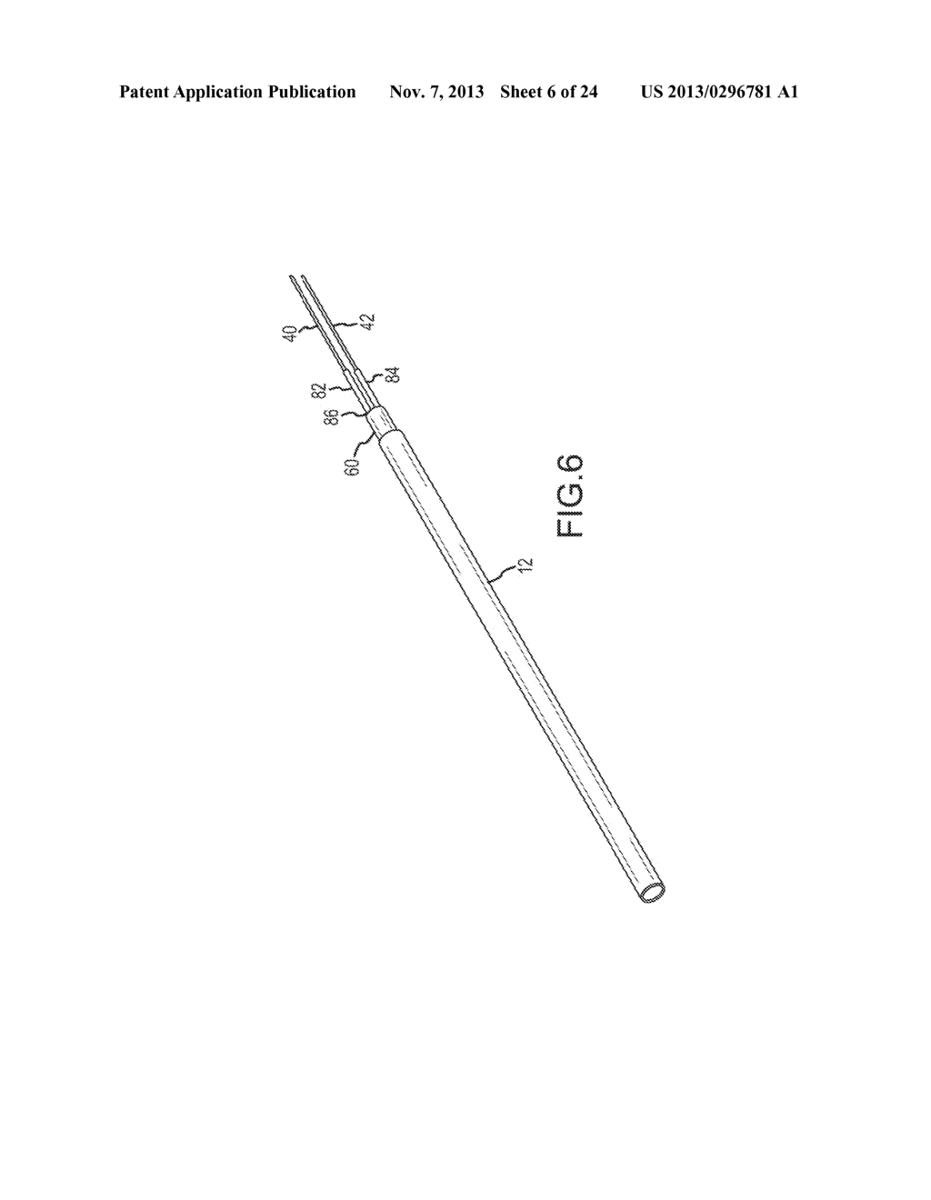 DEFLECTABLE CATHETER SHAFT SECTION, CATHETER INCORPORATING SAME, AND     METHOD OF MANUFACTURING SAME - diagram, schematic, and image 07