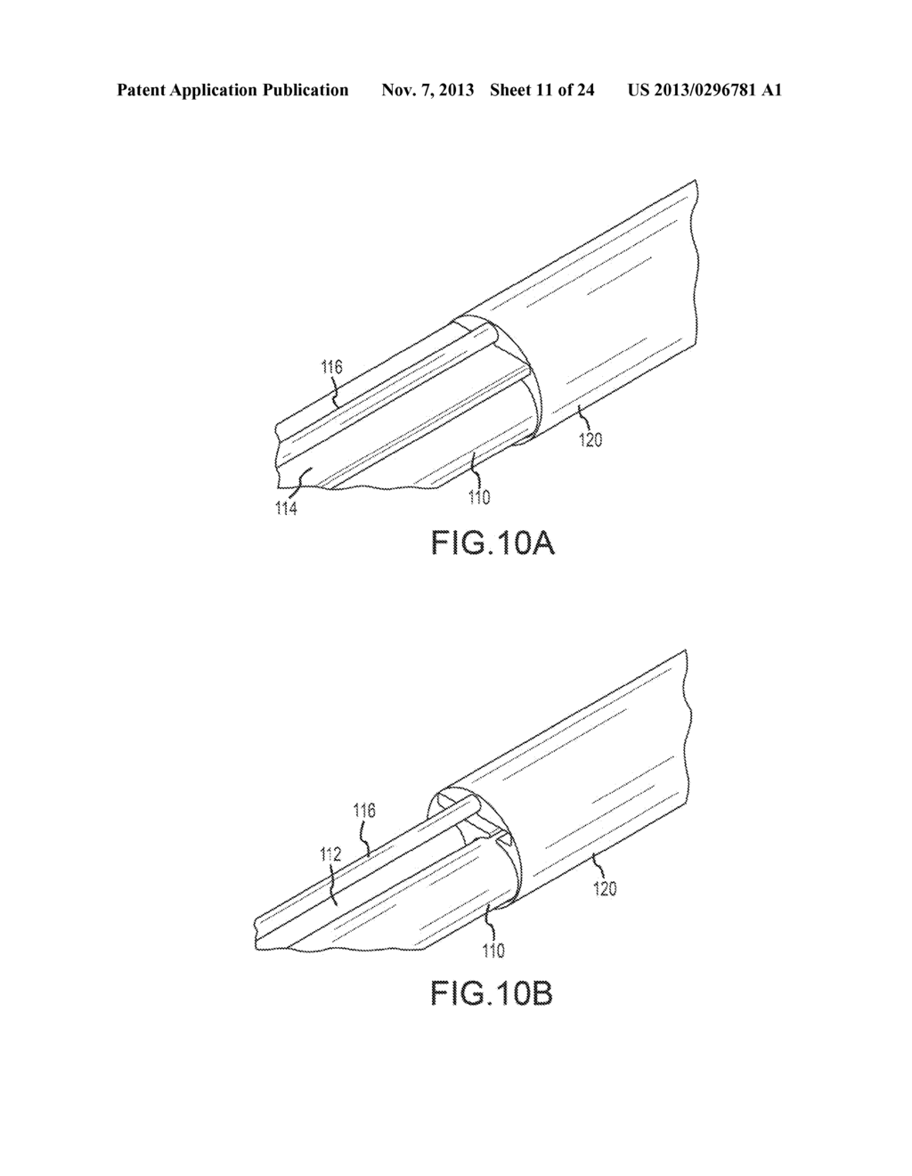 DEFLECTABLE CATHETER SHAFT SECTION, CATHETER INCORPORATING SAME, AND     METHOD OF MANUFACTURING SAME - diagram, schematic, and image 12