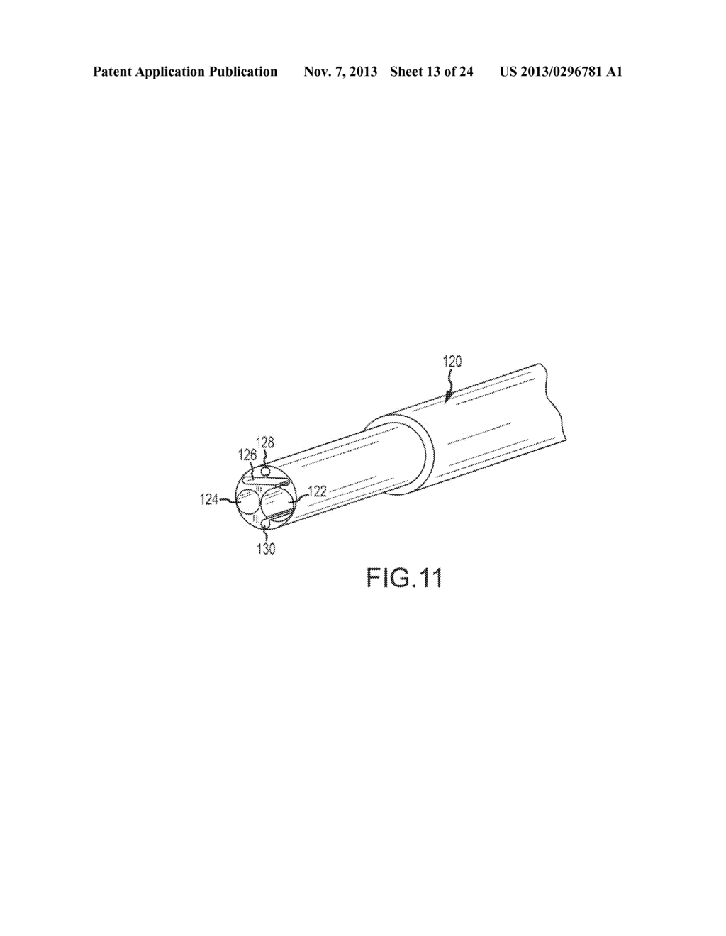 DEFLECTABLE CATHETER SHAFT SECTION, CATHETER INCORPORATING SAME, AND     METHOD OF MANUFACTURING SAME - diagram, schematic, and image 14