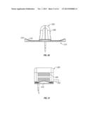 Safety Needle with Positive Flush diagram and image