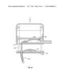 Safety Needle with Positive Flush diagram and image