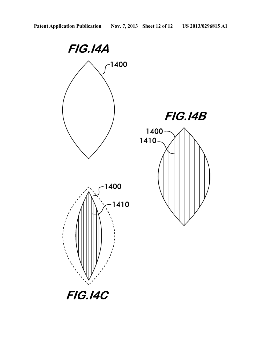 WOUND PACKING MATERIAL FOR USE WITH SUCTION - diagram, schematic, and image 13