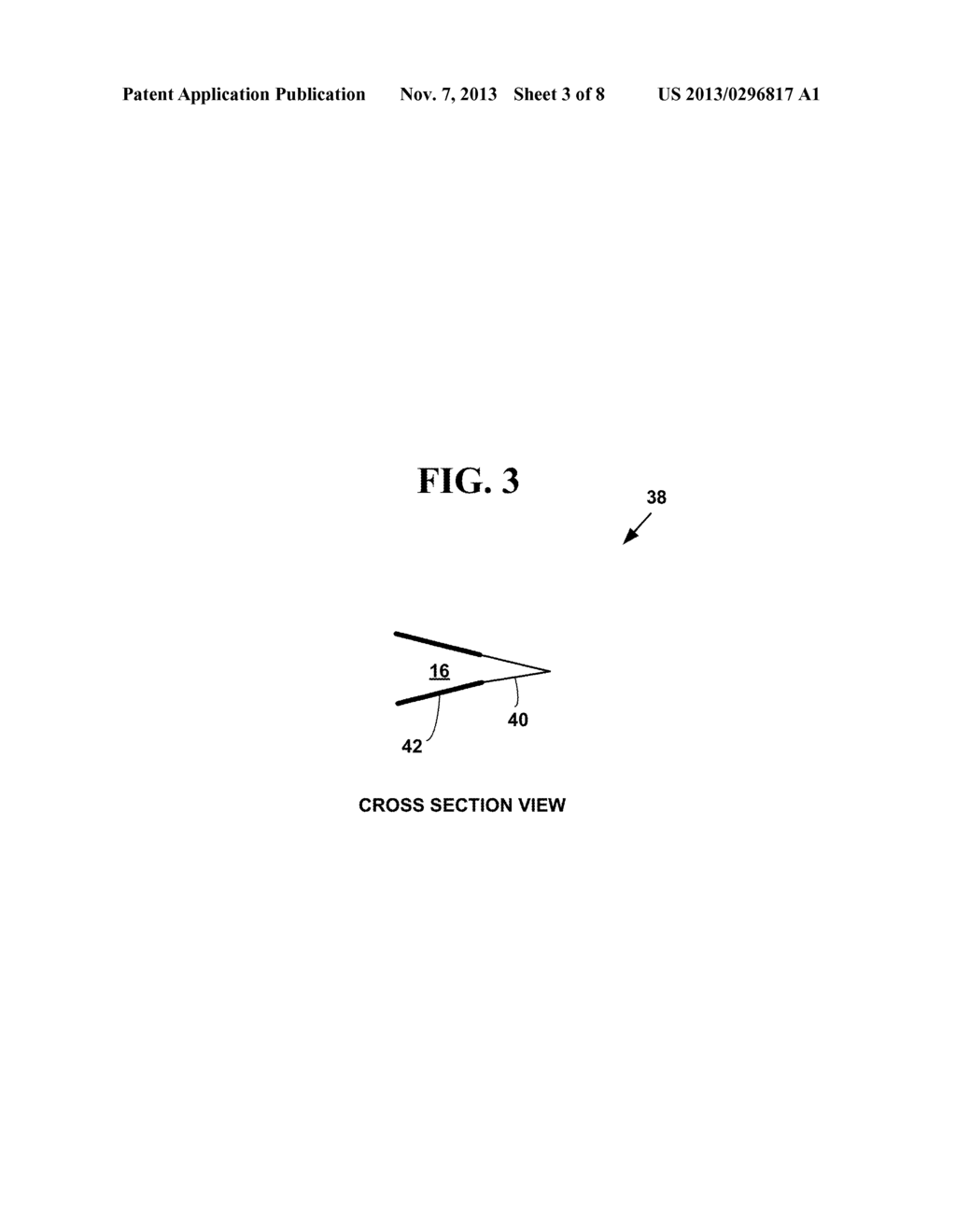 DISPOSABLE PARTIALLY FLEXIBLE SURGICAL FLUID CONTAINER - diagram, schematic, and image 04