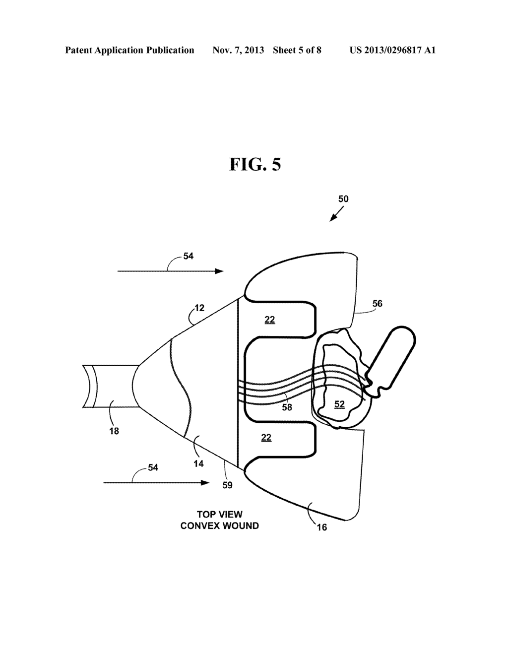 DISPOSABLE PARTIALLY FLEXIBLE SURGICAL FLUID CONTAINER - diagram, schematic, and image 06