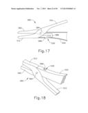 ELECTROSURGICAL DEVICE FOR CUTTING AND COAGULATING diagram and image