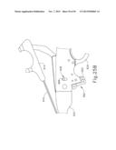 ELECTROSURGICAL DEVICE FOR CUTTING AND COAGULATING diagram and image