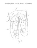 ABLATION CATHETER HAVING TEMPERATURE-CONTROLLED ANCHOR AND RELATED METHODS diagram and image