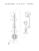 BALLOON CATHETER AND ELECTRIFICATION SYSTEM diagram and image