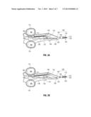 Surgical Forceps diagram and image