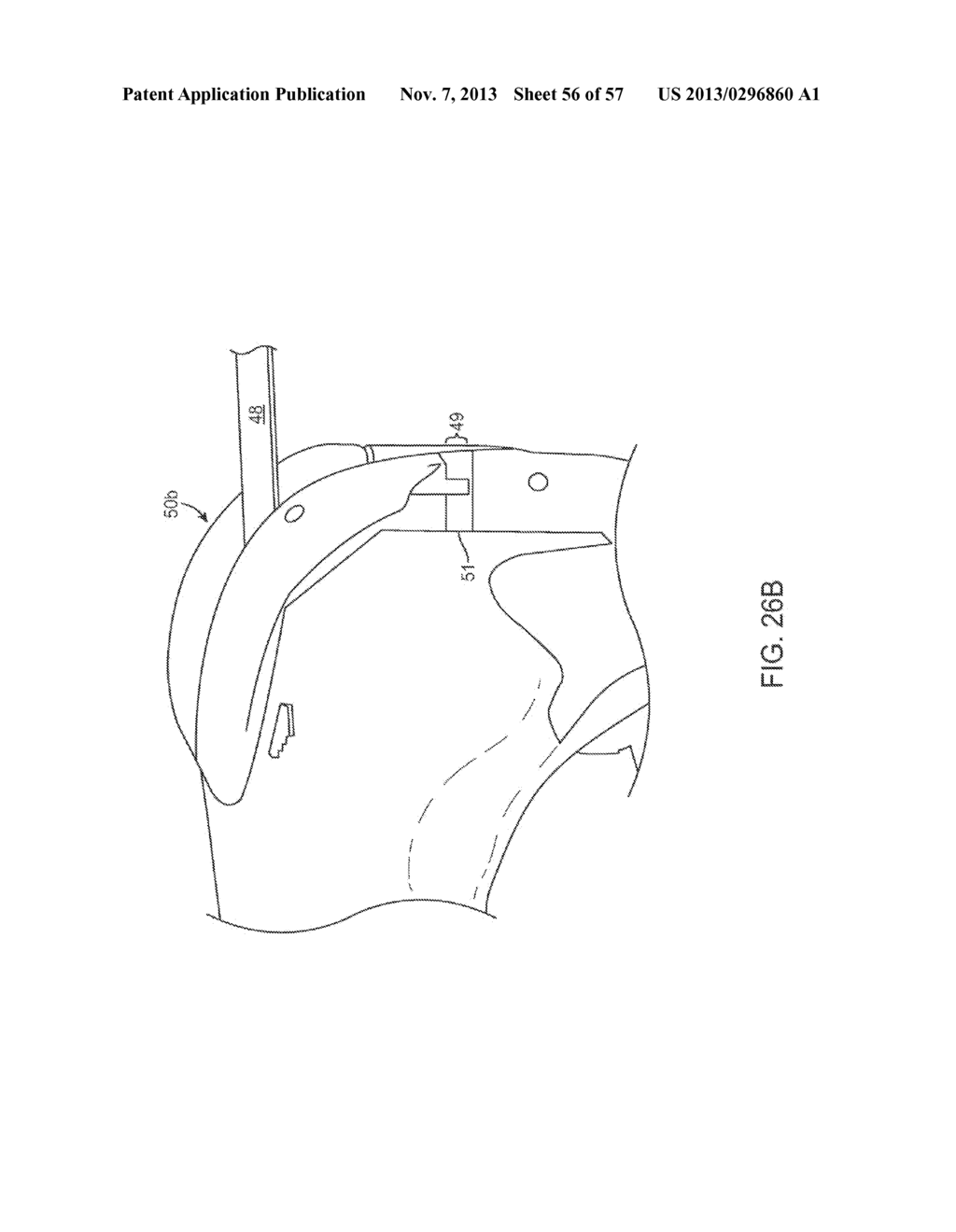 KNEE BALANCING FOR REVISION PROCEDURES - diagram, schematic, and image 57