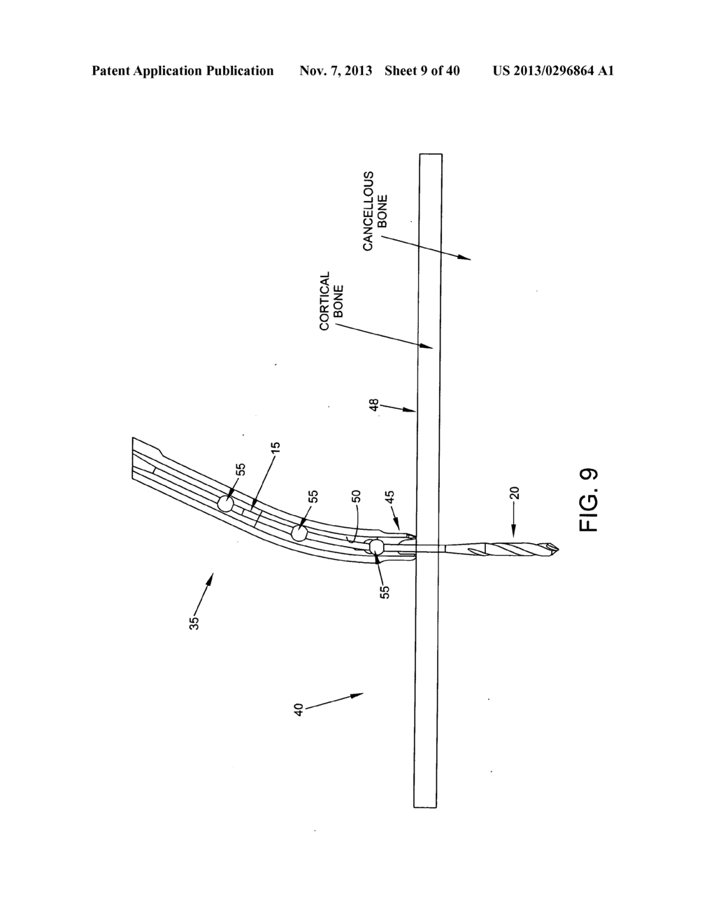 FLEXIBLE DRILL BIT AND ANGLED DRILL GUIDE FOR USE WITH THE SAME - diagram, schematic, and image 10