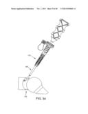 FLEXIBLE DRILL BIT AND ANGLED DRILL GUIDE FOR USE WITH THE SAME diagram and image