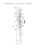 Surgical Guide with Cut Resistant Inserts diagram and image