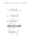 IMPLANT DELIVERY SYSTEM diagram and image