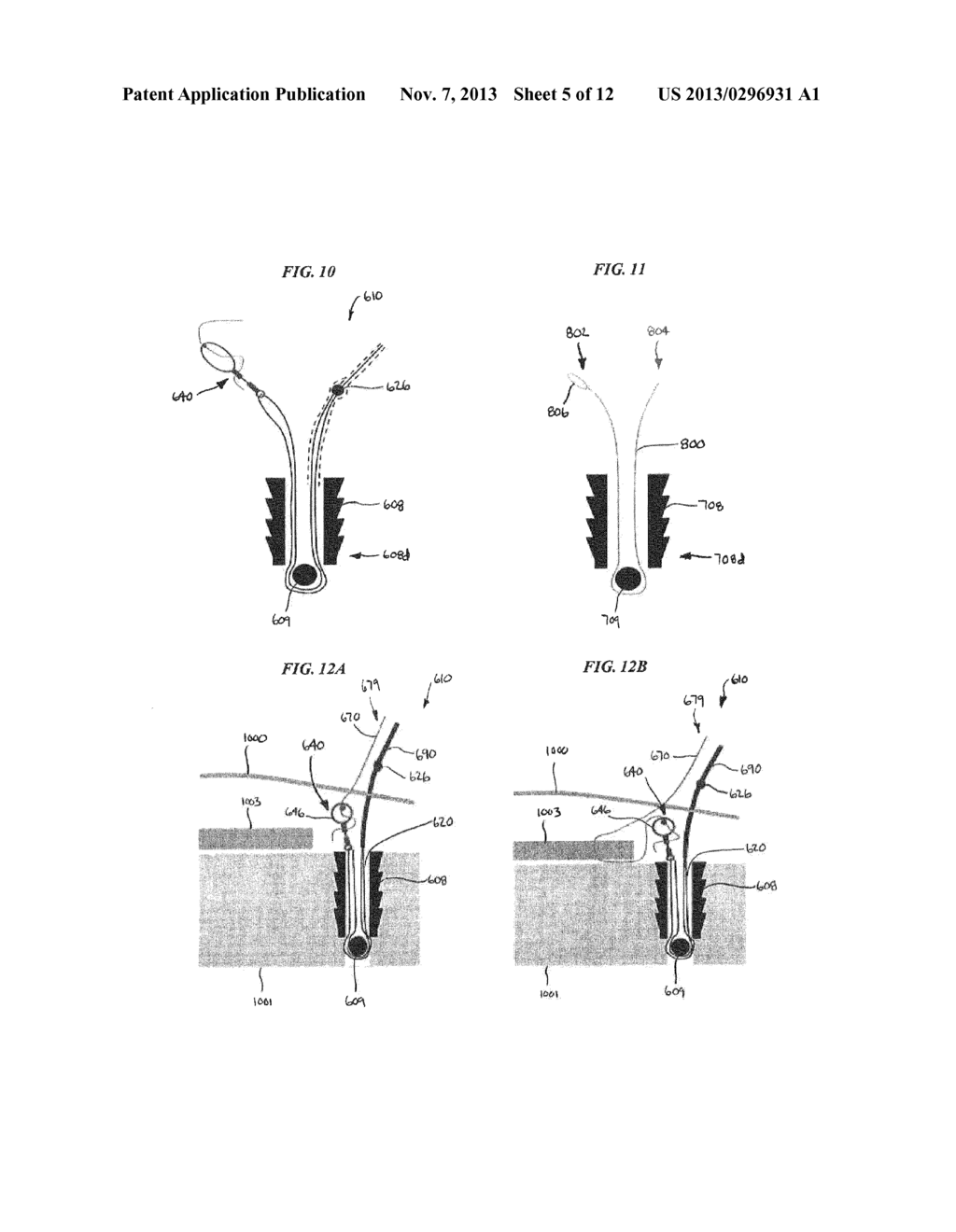 Systems, Devices, and Methods for Securing Tissue - diagram, schematic, and image 06