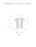 Bone Plate System diagram and image