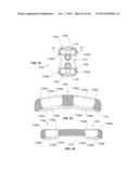 Bone Plate System diagram and image