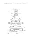 Bone Plate System diagram and image