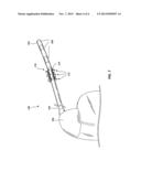 EXPANDABLE FIXATION MECHANISM diagram and image