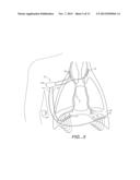 BREATHING DISORDER DETECTION AND THERAPY DELIVERY DEVICE AND METHOD diagram and image