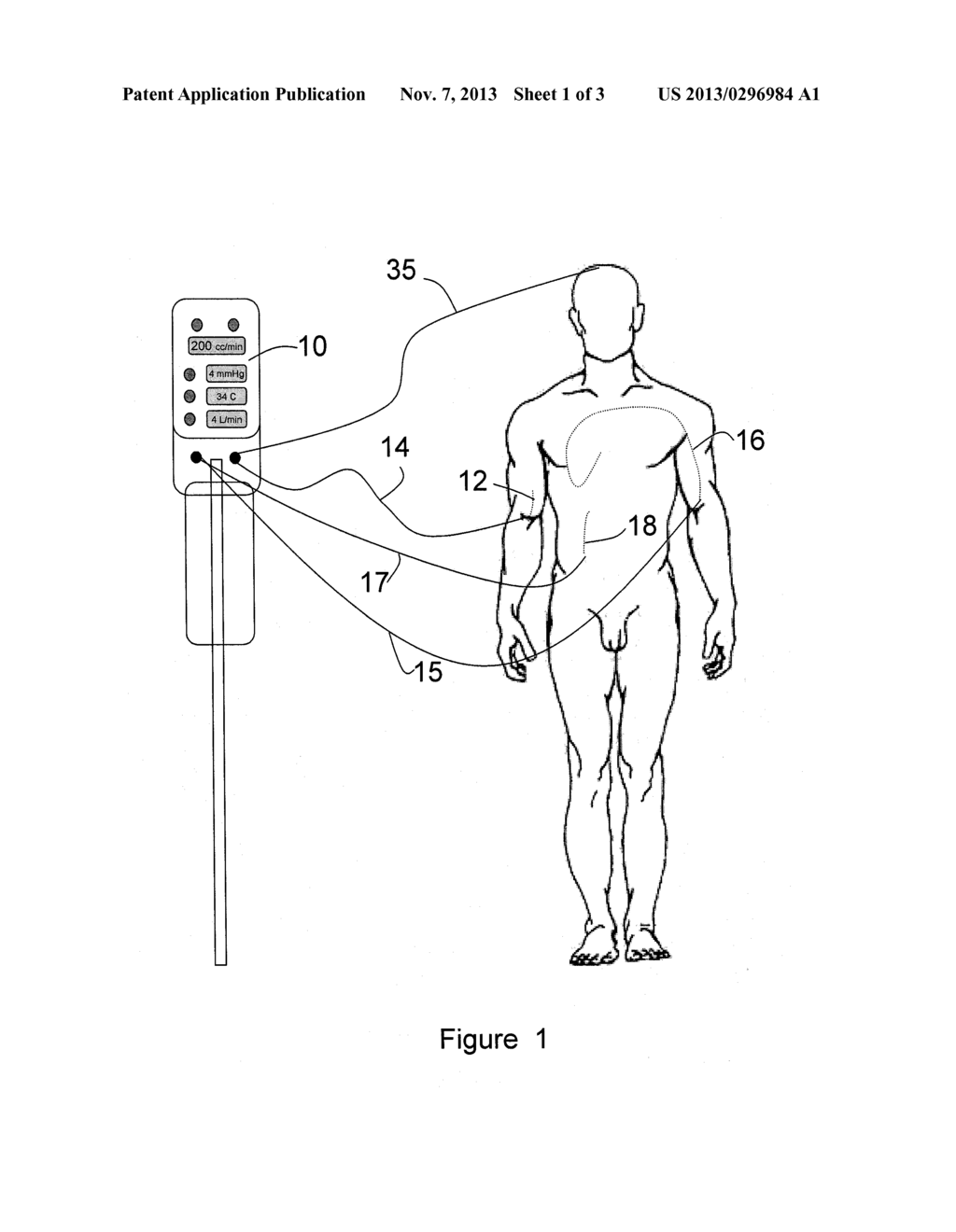 Automated Therapy System and Method - diagram, schematic, and image 02