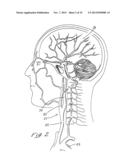 INDWELLING HEAT EXCHANGE CATHETER AND METHOD OF USING SAME diagram and image