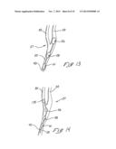 INDWELLING HEAT EXCHANGE CATHETER AND METHOD OF USING SAME diagram and image