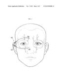 IMPLANTER FOR NERVE STIMULATION diagram and image