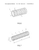 STENT APPARATUS diagram and image