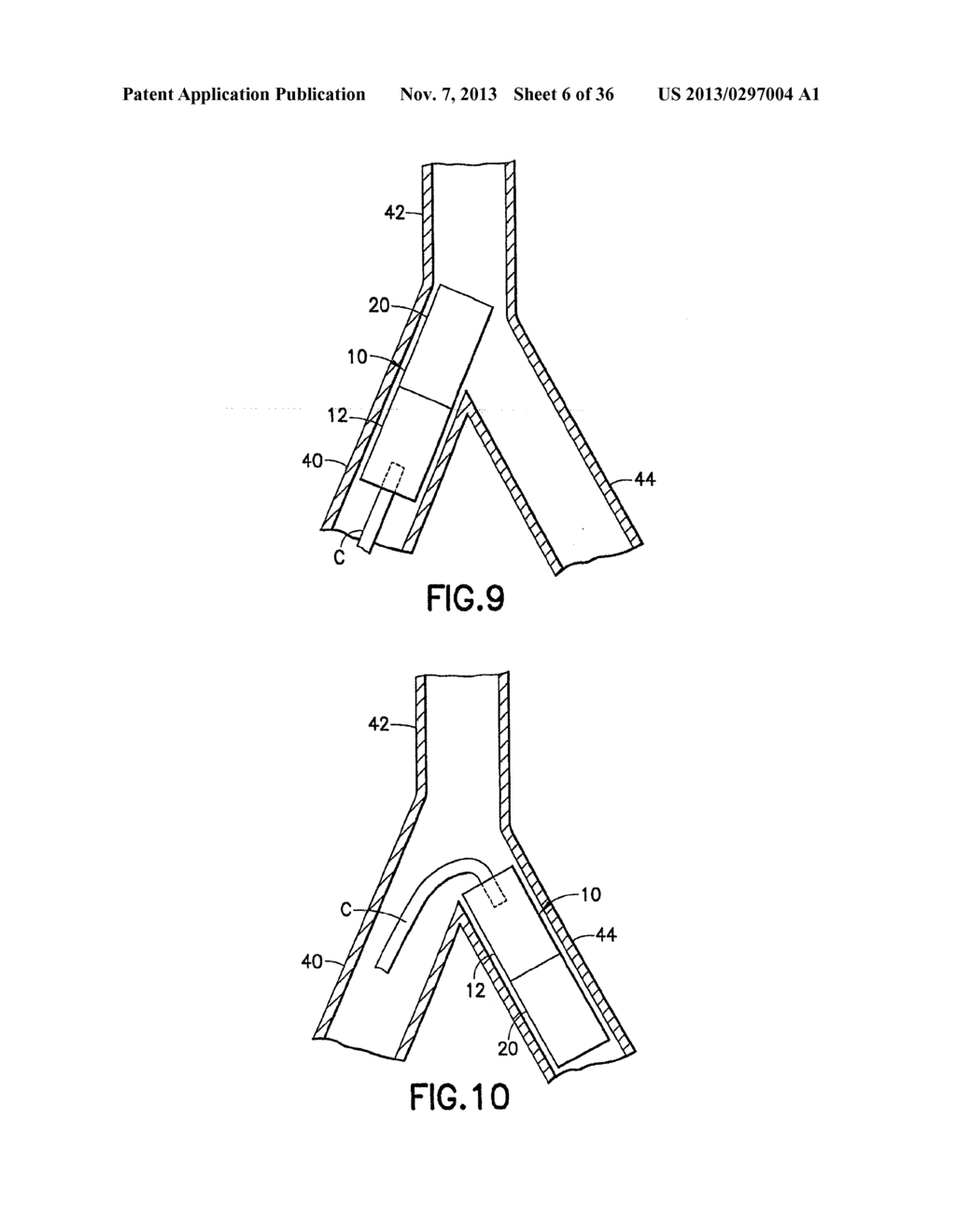 STENT/GRAFT ASSEMBLY - diagram, schematic, and image 07