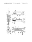 APPARATUS AND METHOD FOR SEQUENTIALLY ANCHORING MULTIPLE GRAFT LIGAMENTS     IN A BONE TUNNEL diagram and image