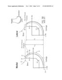 PROSTHESIS AND METHOD FOR USING PROSTHESIS TO FACILITATE DEEP KNEE FLEXION diagram and image