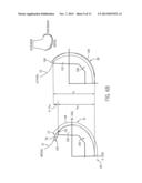 PROSTHESIS AND METHOD FOR USING PROSTHESIS TO FACILITATE DEEP KNEE FLEXION diagram and image